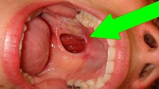 Effects of Tobacco Chewing On Body: Harmful Tobacco Side Effects On The Brain Heart Symptoms Cancer