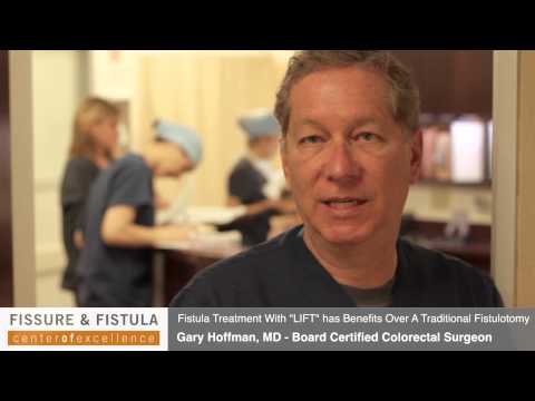 LIFT Procedure for Anal Fistula Treatment