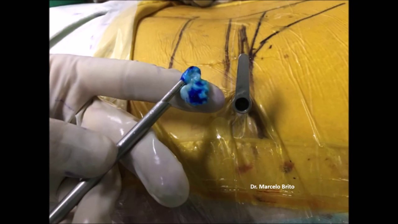 Marcelo Botelho Soares De Brito-22