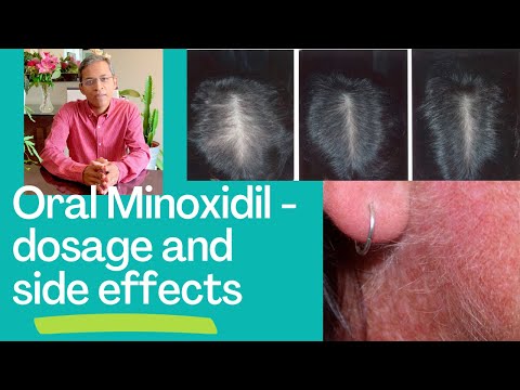 Minoxidil Tablets 10mg - Hair serum supplier from india