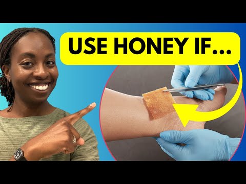 Should You Use Honey on That Wound? Doctor Explains