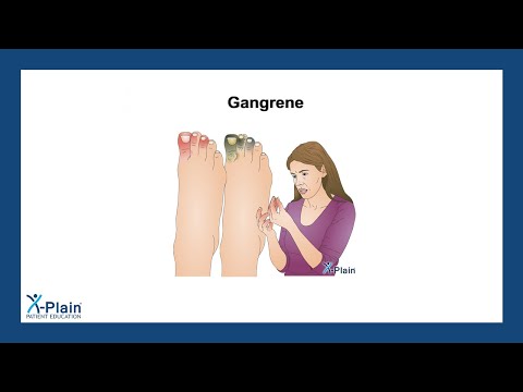 Gangrene