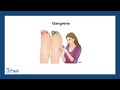 Gangrene