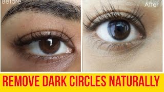 6 Home Remedies To Get rid of Dark circles and Under Eye Bags FAST NATURALLY |
