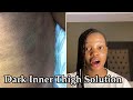 Most Effective Way To Get Rid Of Dark Inner Thigh With No Stretchmark