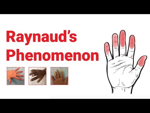 Raynaud’s Phenomenon : What You Should Know | Johns Hopkins Medicine