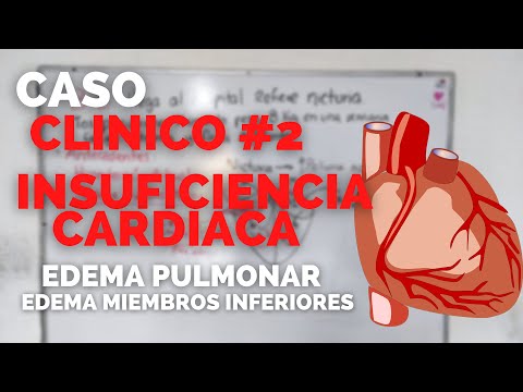 ✅Paciente MASCULINO llega a URGENCIAS por INSUFICIENCIA CARDIACA | CASO CLINICO #2 | ENFERMERIA