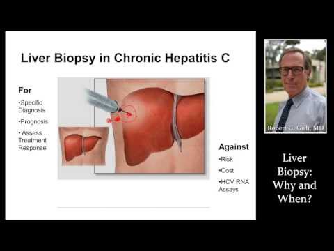 LIVER BIOPSY by Dr. Robert Gish