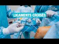 🦵 Chirurgie des LIGAMENTS CROISÉS du genou - Allo Docteurs