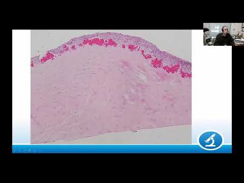 AANP Teaching Rounds - June 23, 2021 - Eye Disease: Illustrative Cases