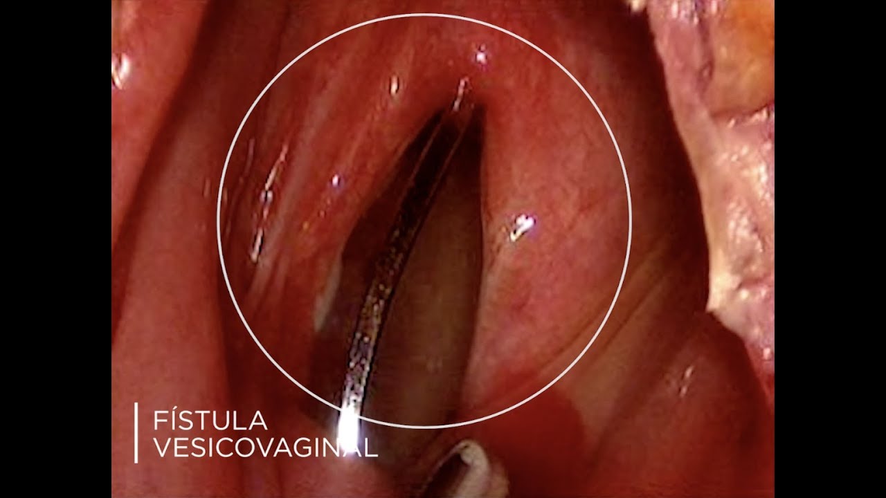 Juan Pablo Santos Uscanga-27