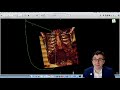 How To Creating A 3D Reconstruction Of Your Patient S CT Scan