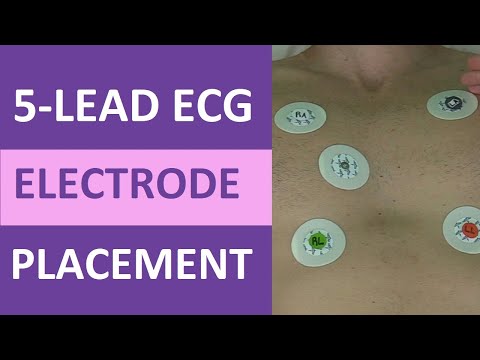 5 Lead ECG Placement of Electrodes (EKG) NCLEX & Nursing Mnemonic