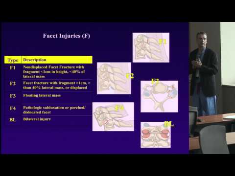 Classifications of Subaxial Cervical Injuries by Andrew T. Dailey, M.D.