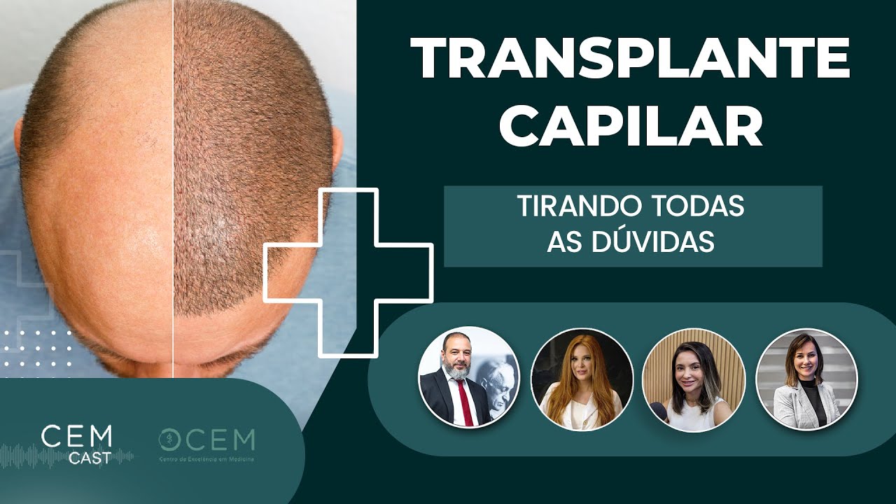 Anabolizantes e Transplante Capilar - Combinam? - CEM CAST Episódio 58