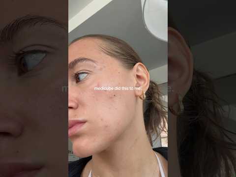 do not use medicube if you have oily/combination skin #acne #skincare