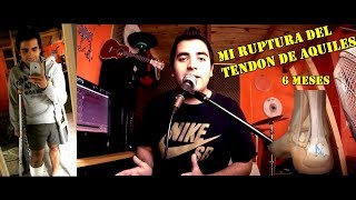 Mi Ruptura Del Tendon De Aquiles (Mi Proceso De Recuperacion)
