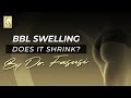 BBL Swelling Does It Shrink Or Get Bigger By Dr Fasusi At Mia Aesthetics