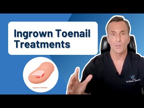 Cosmetic Toe Shortening Long Toe Surgery Video Without Metal Pins