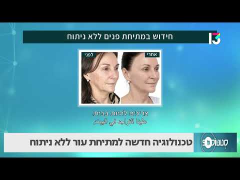 טכנולוגיה חדשה למתיחת עור ללא ניתוחה