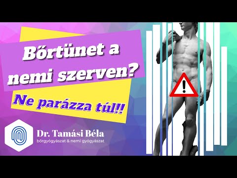 Paraziták embertől emberig