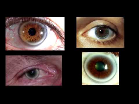 download lagu mp3 mp4 Arco Senil, download lagu Arco Senil gratis, unduh video klip Download Arco Senil Mp3 dan Mp4 Youtube Gratis