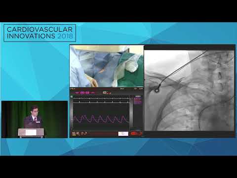 CVI2018 Session: Live Case from York Hospital - Wellspan Health System (July 27. 10:30am)