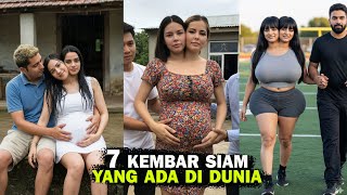 Download lagu 7 Unique Stories of Conjoined Twins with Double Bodies That Shocked the World mp3