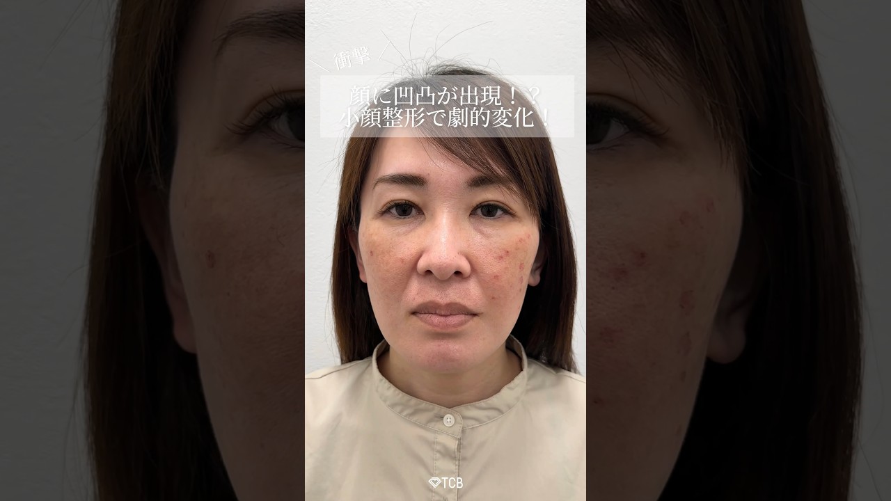 Youtubeのサムネイル