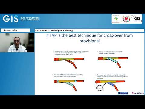 20  Azeem Latib   Left Main PCI – Techniques & Strategy