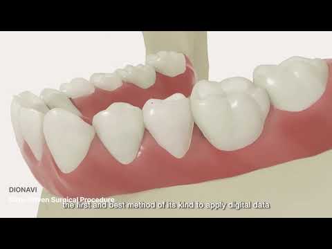 Play Video Youtube Video