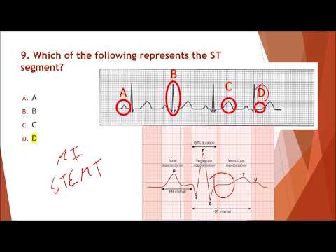 NHA Module 13 EKG and Cardiovascular Testing  Q&A