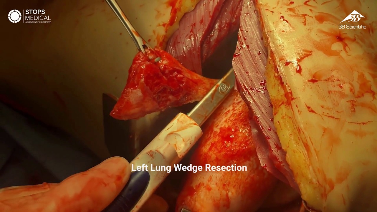 OS3による手術トレーニングの様子│日本スリービー・サイエンティフィック株式会社