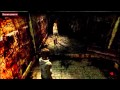 Silent Hill 3 (15 Hopital "Ténèbres" /// Bloodthorn - Breeding the Evil Inside)