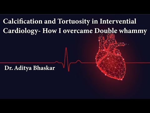 Calcification and Tortuosity in Intervential Cardiology - How I overcame Double whammy