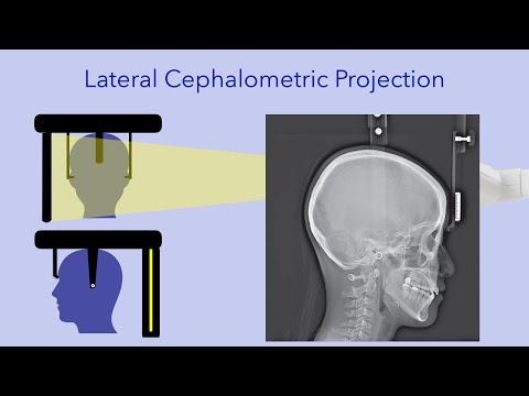 Zasady obrazowania w cefalometrii