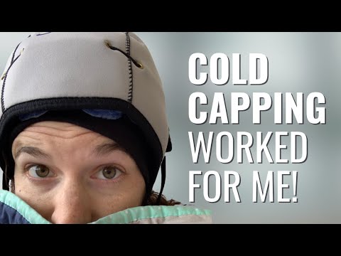 How Cold Cap Therapy SAVED My Hair!  - Alison | Triple Positive Breast Cancer | The Patient Story