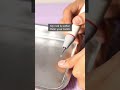 Does Scaling Harm Your Teeth Chopra Dental Care Nungambakkam Dr Pankaj Chopra
