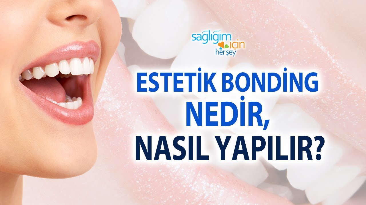 Dişte Estetik Bonding Yöntemi