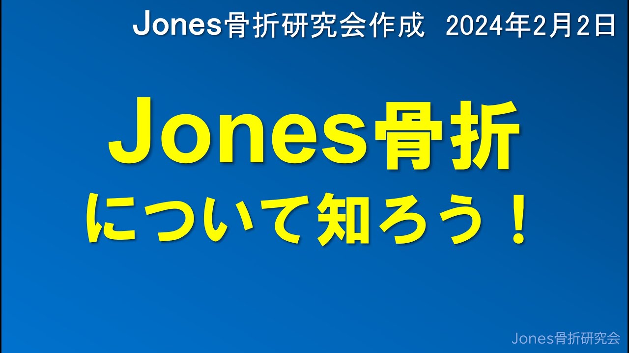 Jones骨折を分かりやすく解説