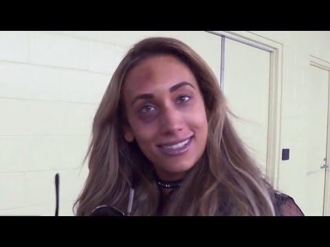 WATCH: Carmella Still Sporting A Black Eye