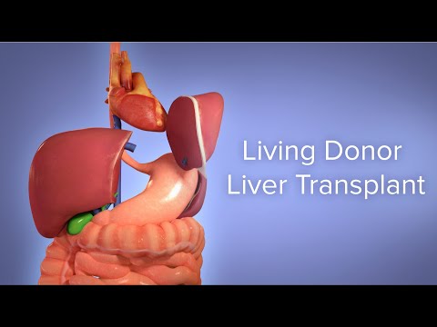 Medical Animation: Living Donor Liver Transplant | Cincinnati Children's