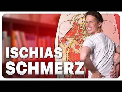 ISCHIASNERV Engstellen Erklärt | Bandscheibe oder Muskelverspannung?