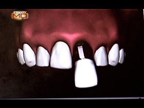 Pagbaba ng timbang ay dapat lamang magsisimulang Mask para sa taba burning paa
