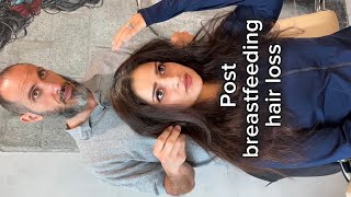 🌸 Why Hair Changes After Pregnancy & Breastfeeding (And When Hair Fall Really Starts)