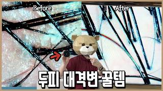 미친 성능의 신이 내린 몸 청소템 l 내돈내산