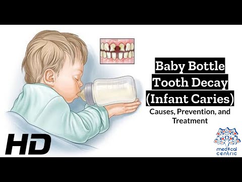 Hydrocephalus Causes Signs and Symptoms Diagnosis and Treatment