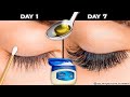 Natural Eyelash And Eyebrow Growth