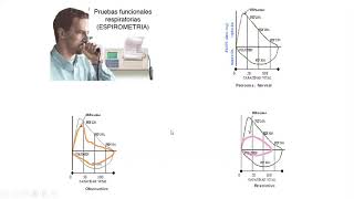 Neumopatías Obstructivas - Asma