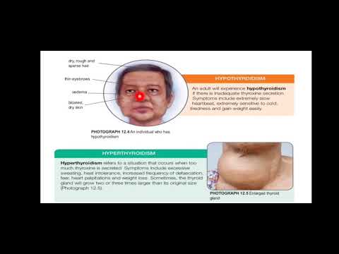 Biology Form 4-Chapter 12|12.7 Health Issues Realated To Human  Endocrine System